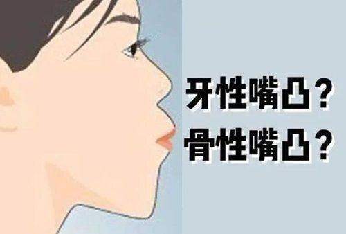 珠海九龙口腔超声波洁牙——优质的服务体验