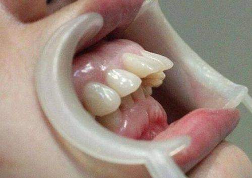 漳州呀哚口腔诊所特色项目：