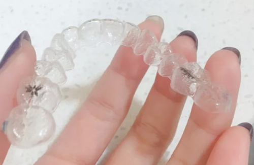 珠海九龙口腔超声波洁牙——精良的设备和技术