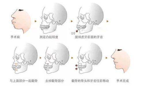 总结