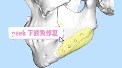 一、深圳悦己悦心医疗美容医院正规吗