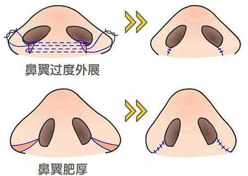 韩国毛杰琳整形医院正规吗？