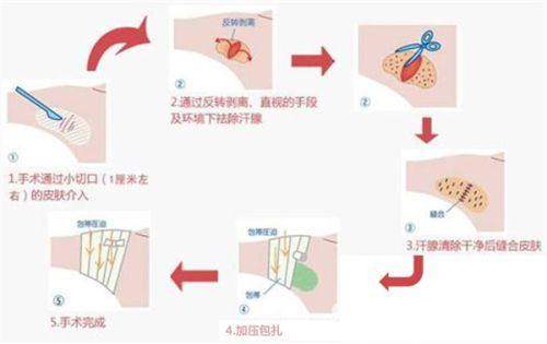 苏州紫馨美容整形项目价格表：2025年双眼皮6800起/隆鼻1.8万起/丰胸2.3万起