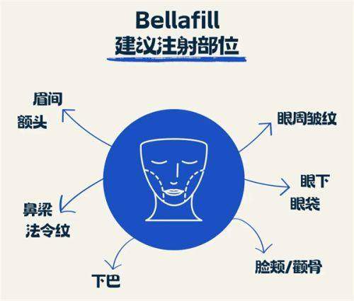 三、沈阳杏林整形外科医院2025价格表之鼻整形优势