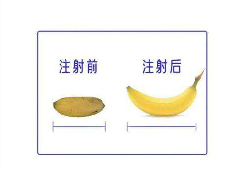 四、上海张园园医生在红睦房中城医院做双眼皮修复