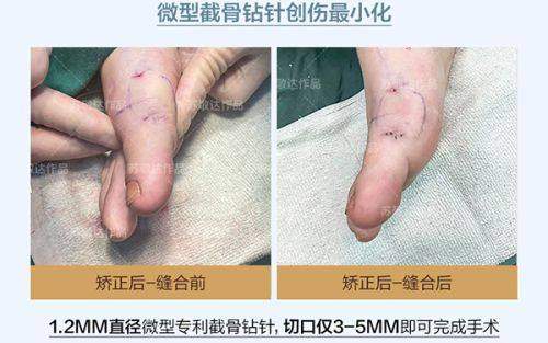 二、深圳南华西晶医疗美容张辉技术实力