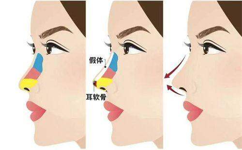 深圳美芮医疗美容门诊部口碑如何？