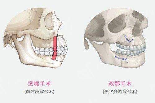 深圳非凡医美价目表曝光！双眼皮2500起，隆胸2.4万，热玛吉1万起