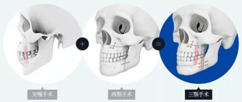 七、北京八大处张海明与张超医生风格对比