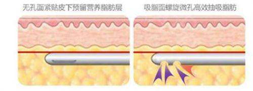 二、湛江华美医疗美容医院怎么样？