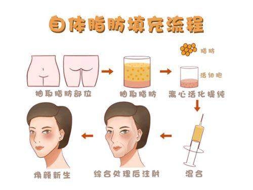 五、东莞中小型诊所黄金微针价格特点