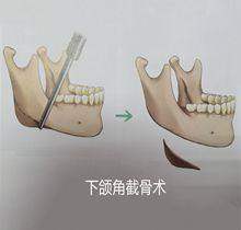 韩国友珍整形外科医院特色项目：