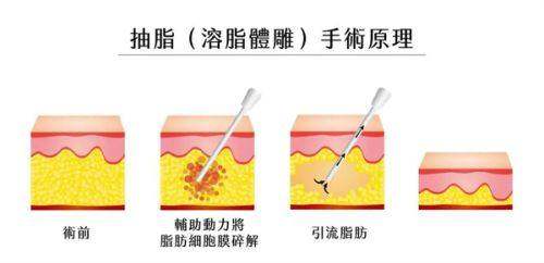 韩国清潭珠颜美容医院