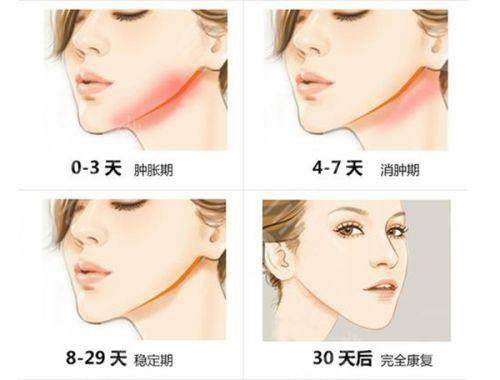 四、7d聚拉提的市场现状