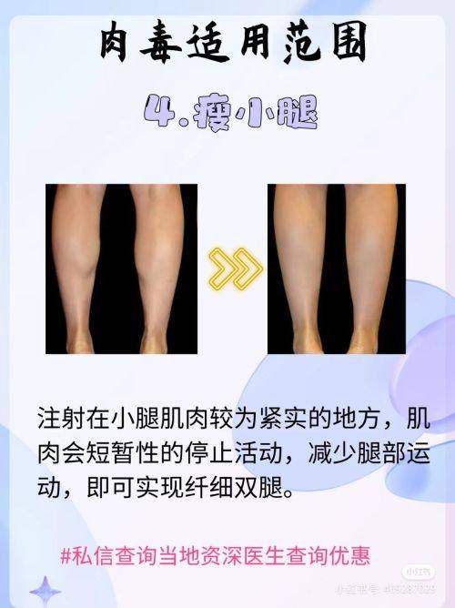 深圳雅尊医疗美容门诊部口碑如何？