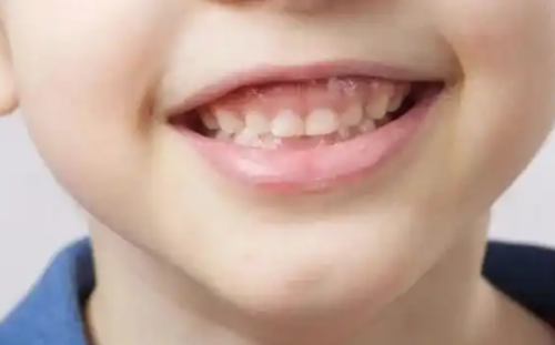 咸阳小白兔口腔门诊部正规吗？
