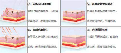 三、北京米兰柏羽丽都医疗美容曹卫华医生眼部整形解析