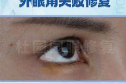 七、北京纯脂2025冯斌医生医疗项目全攻略