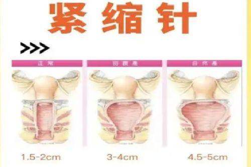 四、北京沃尔医院鼻子整形在线询问