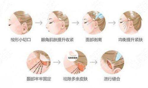 保定华仁疤痕修复医院口碑如何？
