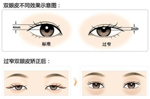 四、海口美咖医疗美容——海口整形医院哪家好的后起之秀