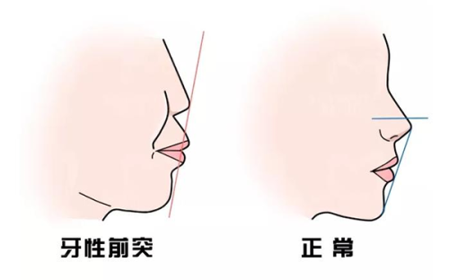 二、北京奥尔贝德赵军舰医生的吸脂技术解析