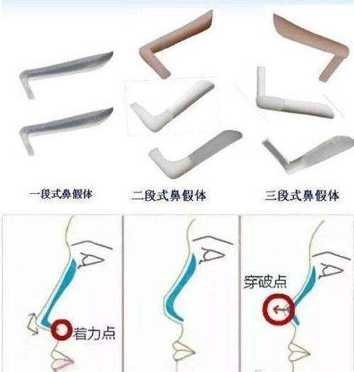 四、西安中诺口腔