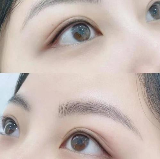 3. 武汉仁爱时光激光去红血丝：合理的价格