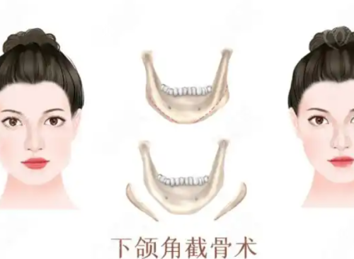 韩国宝士丽整形外科医院