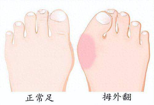 刘超医生真实口碑评价：