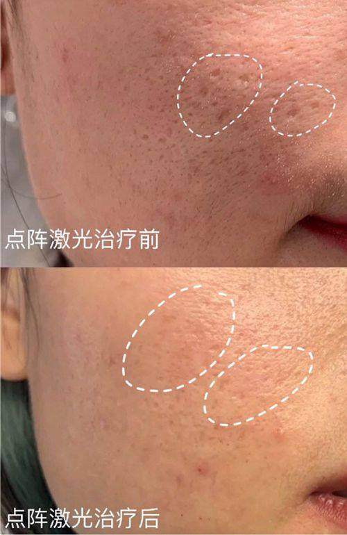 北京柏晟医疗美容门诊部预约挂号方式：