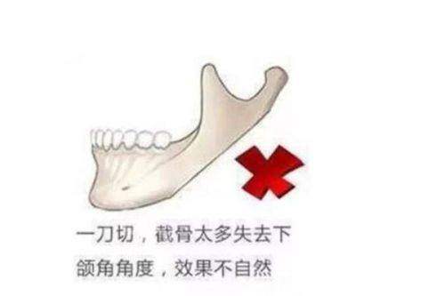 韩国丽迪安整形医院
