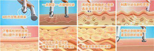 韩国菲斯莱茵faceline整形医院预约挂号方式：