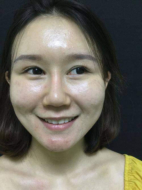 三、重庆军美整形医院——重庆富贵包去除的吸脂专长