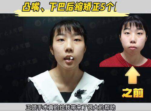 韩国IOU整形外科医院收费价格表：