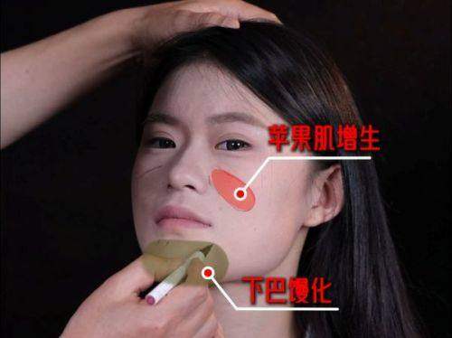 二、北京艺星王博谦医生的特色眼部整形技术