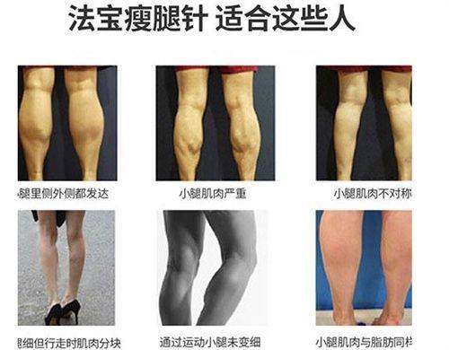 张佑阳医生收费价格：