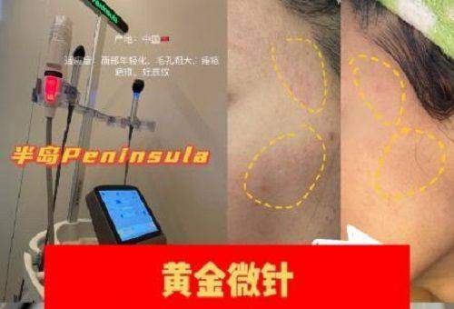 哈尔滨市第三医院（医疗美容科）收费价格表：