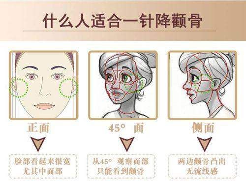 韩国TL整形医院预约挂号方式：