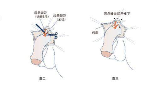 武汉爱美汇医疗美容门诊部特色项目：