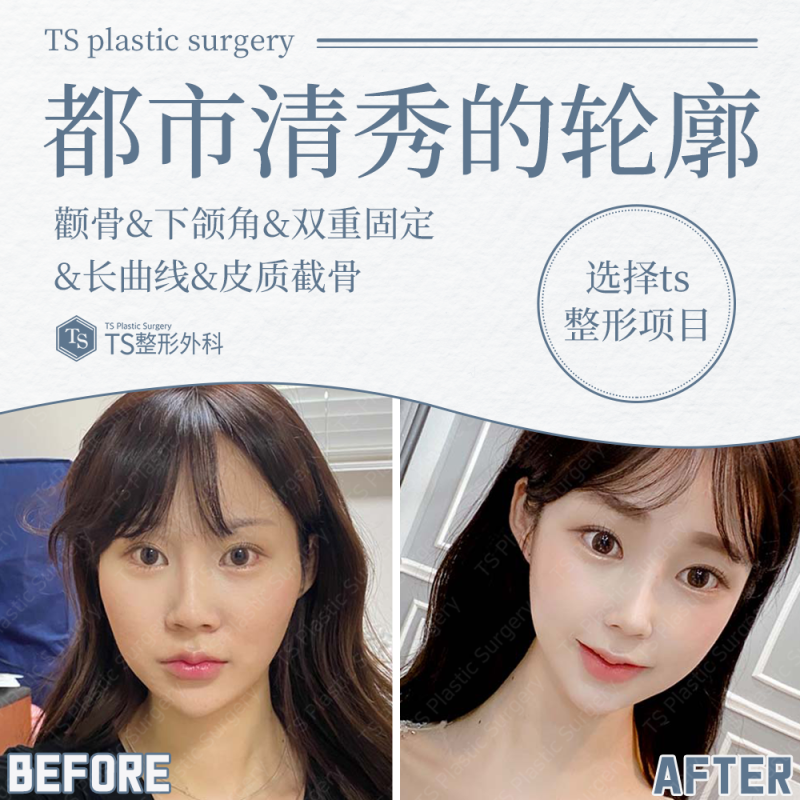 武汉爱美汇医疗美容门诊部正规吗？