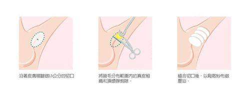 六、东莞科生植发医院——国内外合作的典范