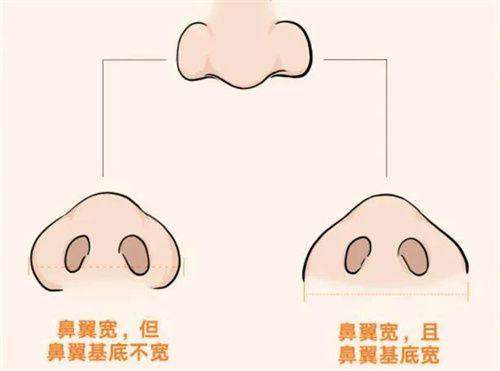 韩国天鹅swan整形外科医院