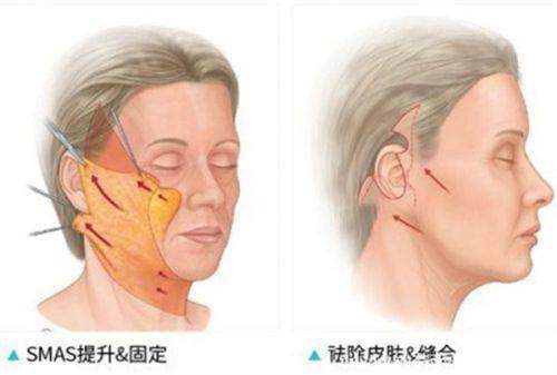 长春市中 心医院（医疗美容科）预约挂号方式：