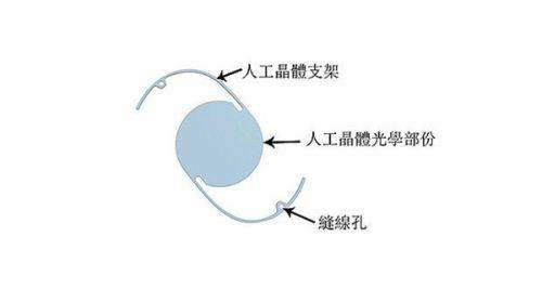 韩国天鹅swan整形外科医院口碑如何？