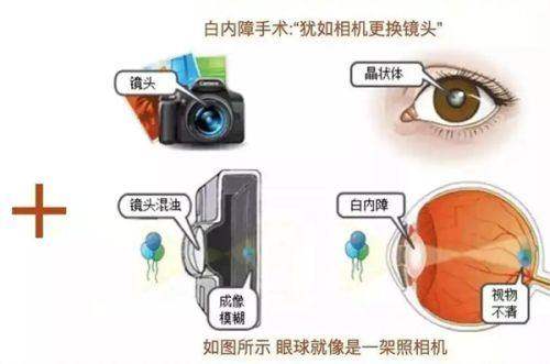 韩国天鹅swan整形外科医院收费价格表：