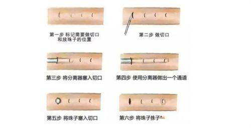 3. 北京京城皮肤医院黄金超光子优势明显
