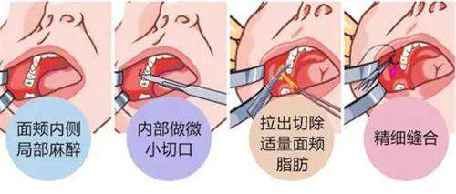 韩国吴佳娜皮肤科医院收费价格表：