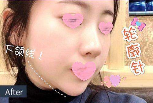 韩国优雅人整形外科医院