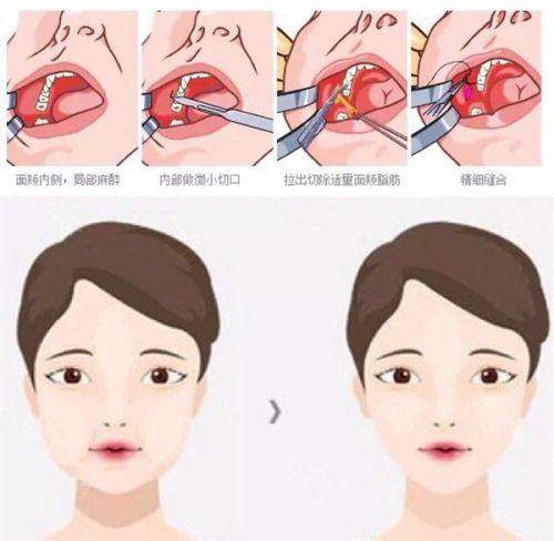 韩国优雅人整形外科医院地址电话及营业时间：